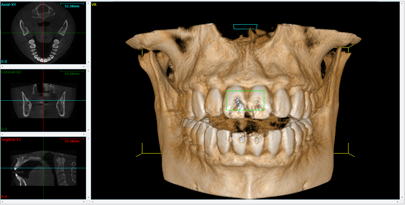 Cone Beam 3D Imaging  Lomita, CA 
